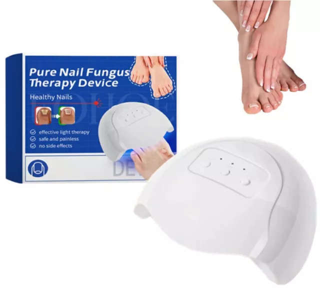 Furzero Purenail Fungus Laser Therapy Device, Fungal Nail Light Therapy Device