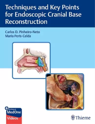 Pinheiro-Neto Techniques and Key Points for Endoscopic Book NEUF