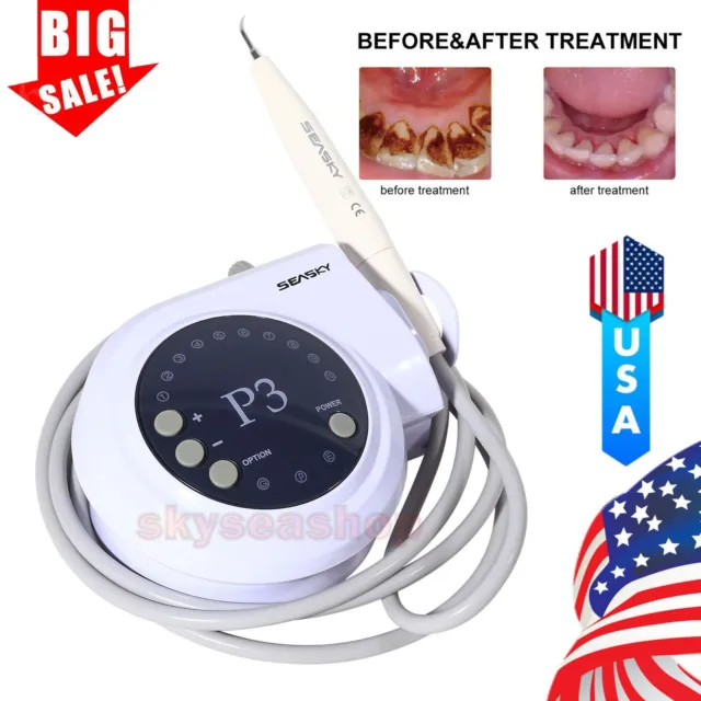 Dental Ultrasonic Scaler Tooth Clean fits DTE Satelec tips tube