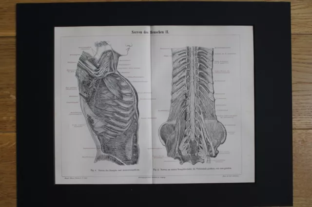 Grafik Kunstdruck von 1894 Mediziner Heilpraktiker Nerven des Menschen II