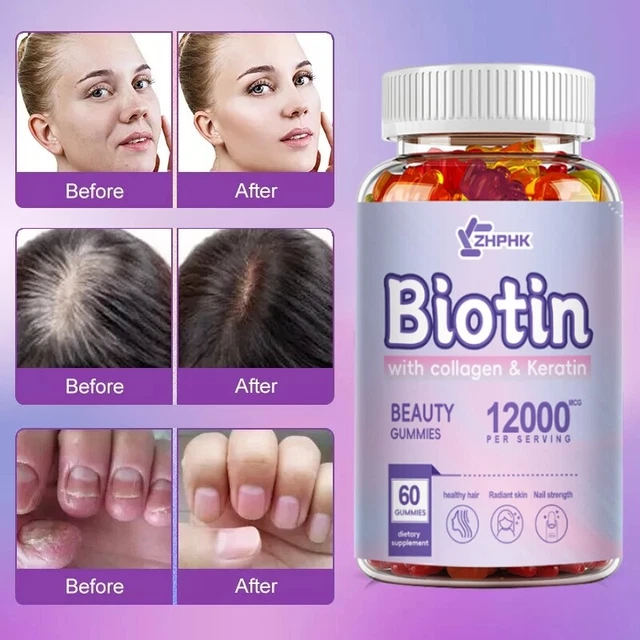 HAIR GROWTH GUMMIES, Biotin 12,000mcg Collagen Multivitamin for Hair ...