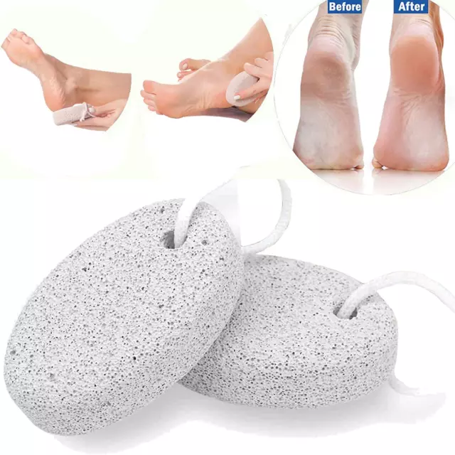Pietra pomice per piedi set 2 pz_pietre pomice naturali cura dei piedi per duro morto