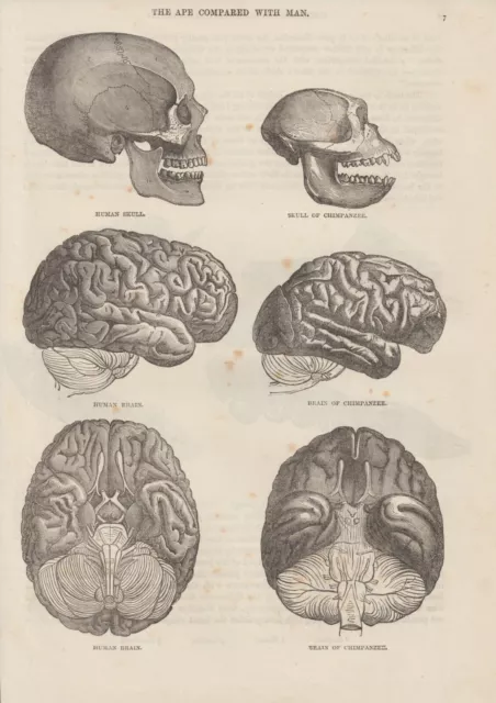 Schädel Vergleich Mensch Schimpanse Gehirn brain HOLZLSTICH von 1866