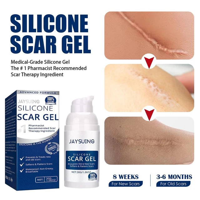 Gel cicatrici avanzato tuck per la pancia vecchie cicatrici segni stretch bruciore ScarE2