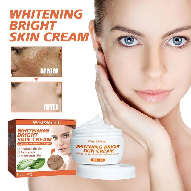 30 g crema sbiancante efficace rimozione lentiggini melasma acne pigmento macchie scure