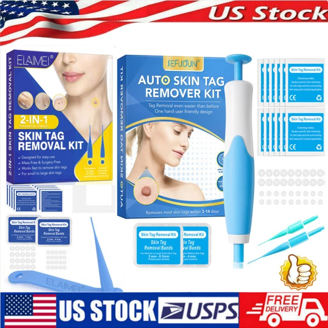 AUTO MICRO SKIN Tag Remover Device Kit Safe Painless Removal 28 mm