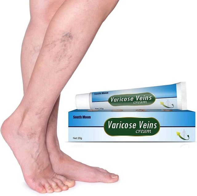 Crema para venas varicosas reparación de piernas - mejora la circulación sanguínea alivio piernas cansadas