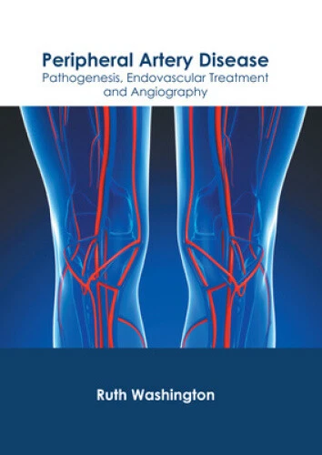 PERIPHERAL ARTERY DISEASE: Pathogenesis, Endovascular Treatment and ...