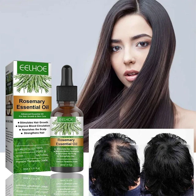 Extracto de loción para el crecimiento del cabello pérdida de cabello aceite calvicie reparación