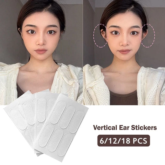 Pegatina para oreja vertical chapa convertida en corrección de orejas pegatinas para orejas esmeriladas