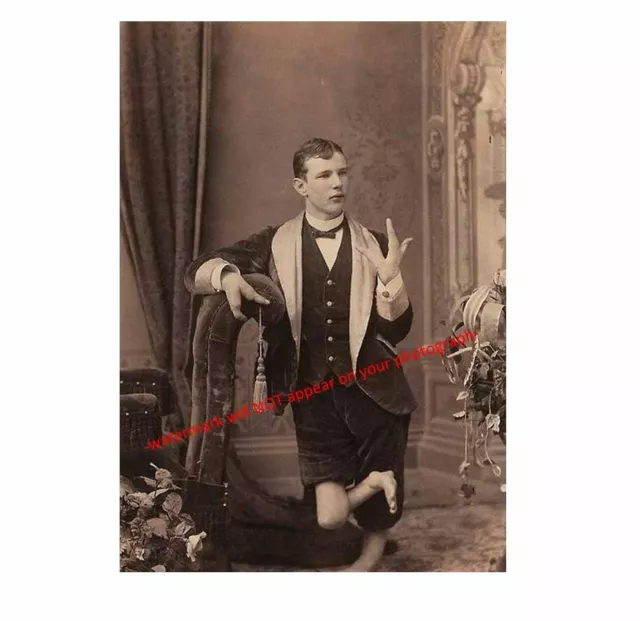 Vintage Creepy Lobster Boy PHOTO Scary Sideshow Circus Freak Boy