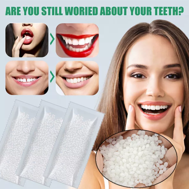 Temporary Tooth Repair Kit Fix Broken Teeth And Fills Gaps Non Toxic Teeth Glue