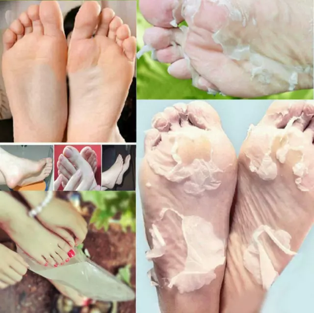 Peeling Peeling Fußmaske Socken Baby weiche Füße Erneuerung entfernt abgestorbene Haut Schwielen