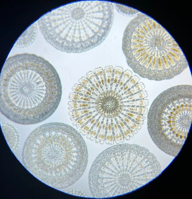 19th Century J.D. Moller Microscope Slide Arranged Echinoidea / Sea Urchin