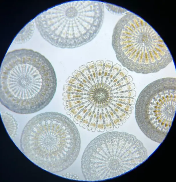 19th Century J.D. Moller Microscope Slide Arranged Sea Urchin! Beautiful
