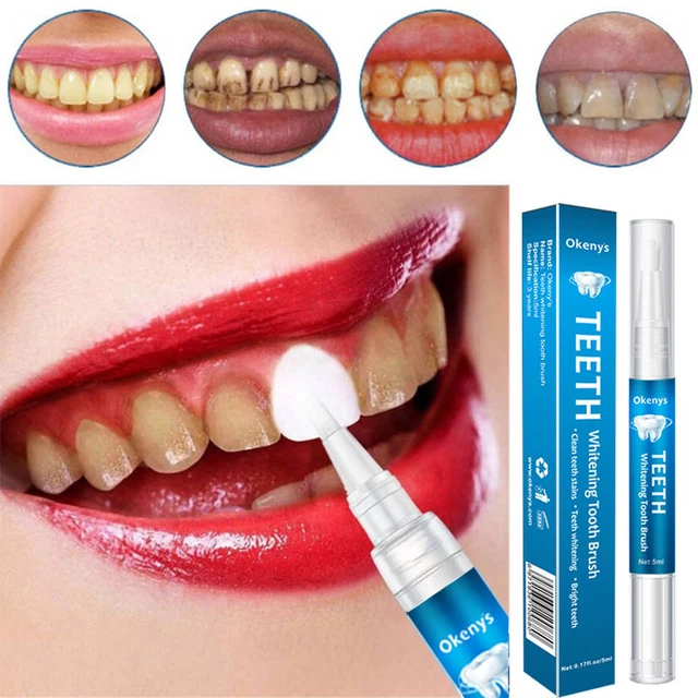Pluma blanqueadora dental de 5 ml pluma limpiadora dental saludable efectiva para eliminar dientes