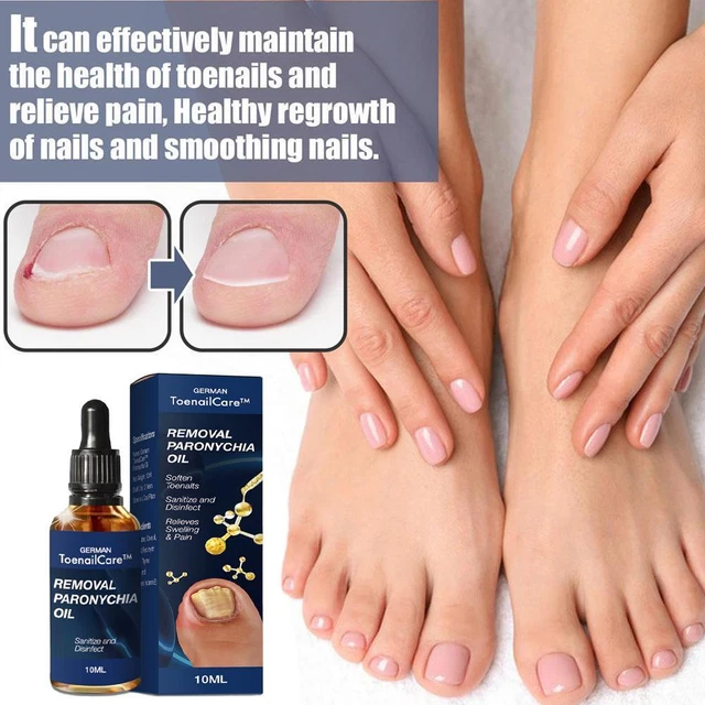 Toenail & Skin Conditions Treatment - Podiatrist Fairfax VA — CENTER FOR  FOOT & ANKLE CARE, PC