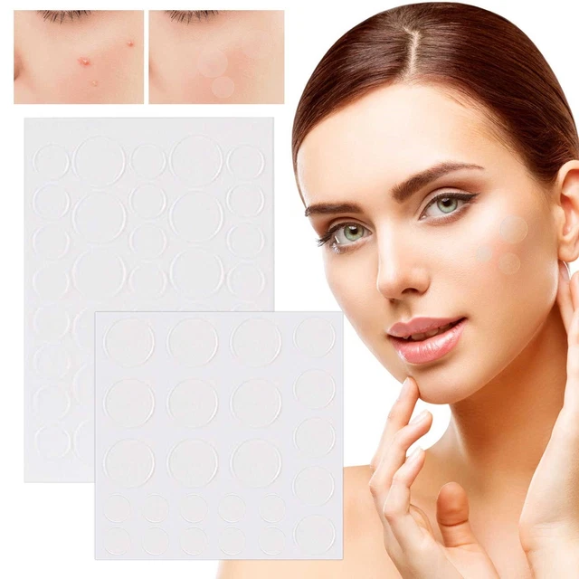 Pegatinas para eliminar el acné parche facial para espinillas para acné corrector facial