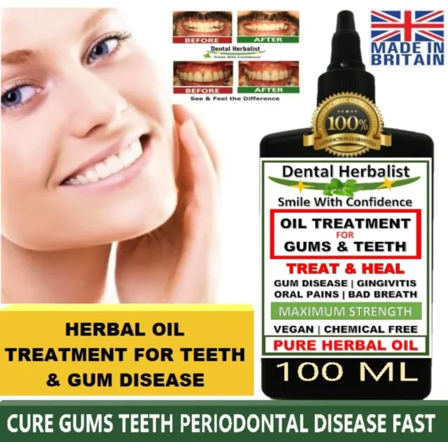 Aids to Rebuild Receded Gums Surrounding Your Teeth Pure Herbal Oil – 100 ML