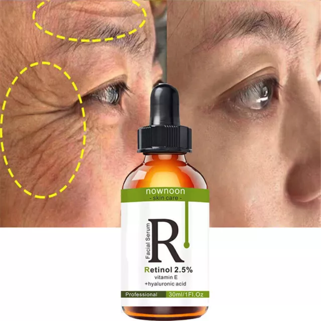 Retinol 2.5% Vitamin A C E + Hyaluronic Acid Face Serum Anti-Aging Anti-Wrinkles