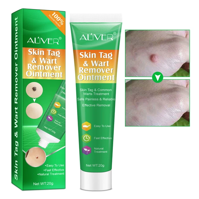 SAFE FAST EFFECTIVE Cream Acne Spot Mole 20g Wart & Skin Tag Remover