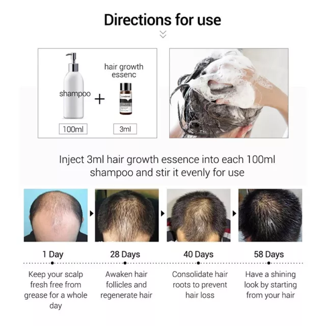 LANBENA Intensive Hair Growth Essential Oil AntiHair Loss Hair Treatment Essence