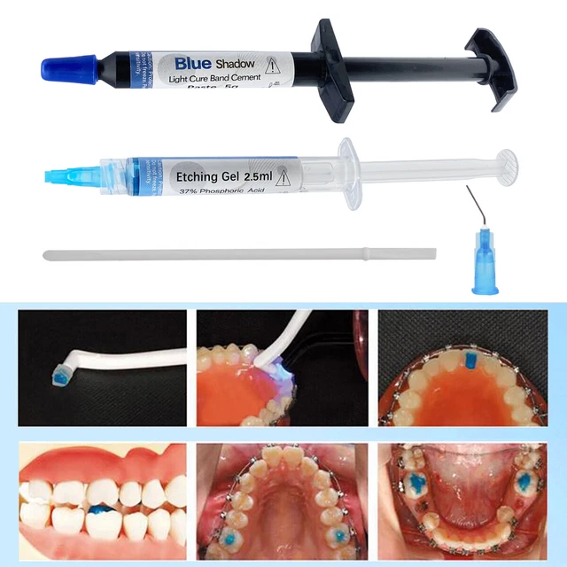 DENTAL ORTHODONTIC ADHESIVE Light Cure Band Cement Blue Glue Kit For