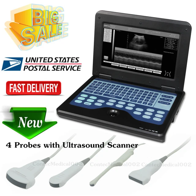 Digital Ultrasound Scanner Laptop Machine 4 Probes Convex/Cardiac/Linear/Vaginal