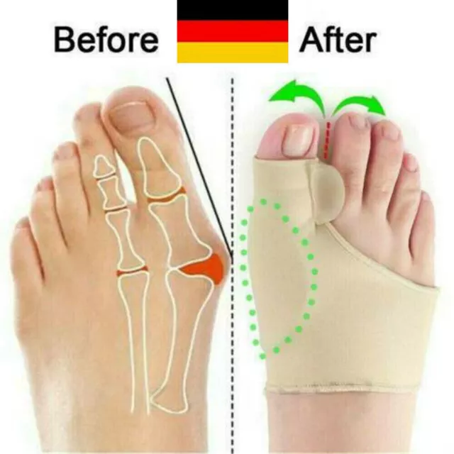 2X Zehenspreizer Hallux Valgus Korrektur - Bunion-Socke - Silikon Gel Bandage ~