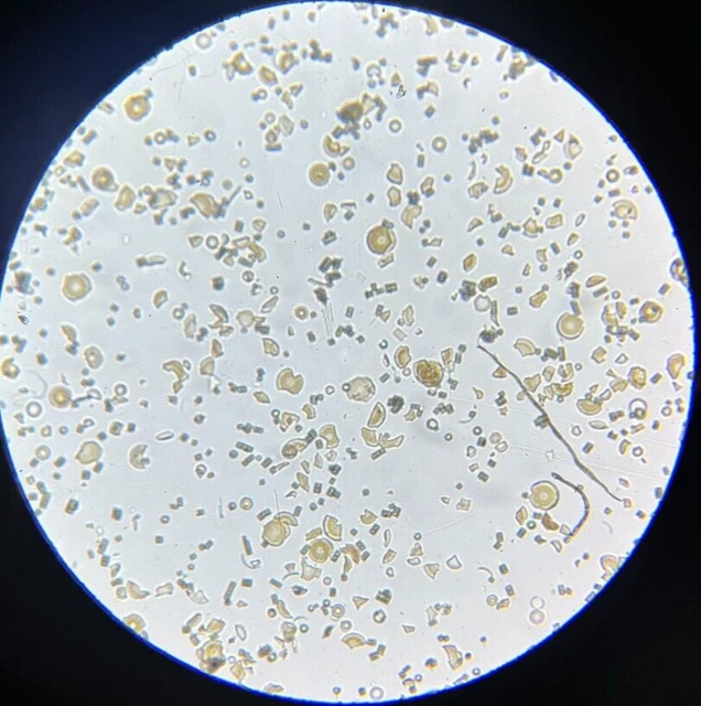 J.D. Moller Microscope Slide Diatom Fossil Carcon California USA Gold Medal 1869