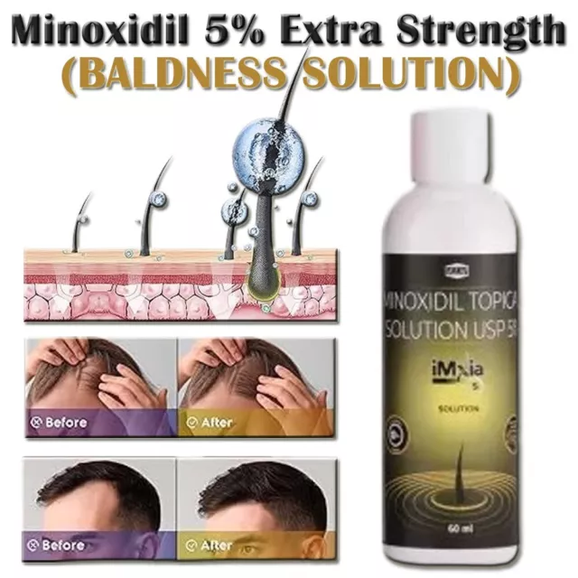 Minoxidil 5% fuerza extra suministro de 3 meses crecimiento del cabello para hombres 2
