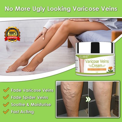 Crème Traitement Varices & Veines D'Araignée | Anti-Phlébite & Vasculite | Soin Jambes Légères
