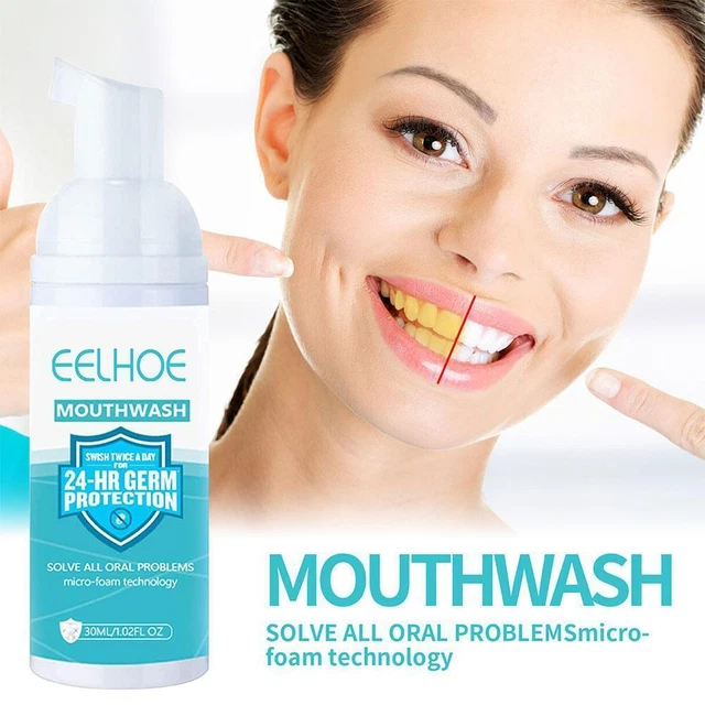 Blanqueamiento dental blanqueamiento dental para gel más blanco higiene oral pasta de dientes espuma Au