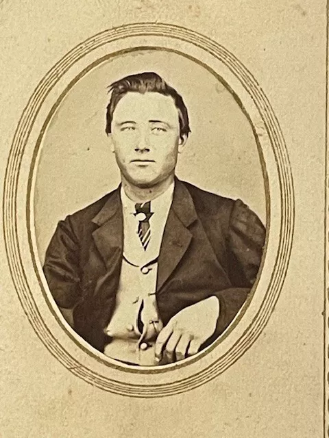Antique CDV Young Man Unbuttoned Vest Civil War Era Unknown Photographer Revenue