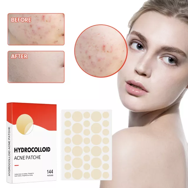 Hydrocolloid Pimple Patches Spot Acne Removal Patch Plaster Invisible Spot Cover 3