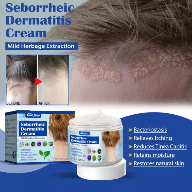 Seborrheic Hautcreme Scalp Treatment Beruhigende feuchtigkeitsspendende Salbe