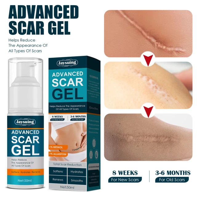 ScarAway Advanced Scar Gel,Tummy Tuck,Old Scars,Stretch Marks,Burn Scars 50ml ScarAway Advanced Scar Gel,Tummy Tuck,Old Scars,Stretch Marks,Burn Scars 50ml