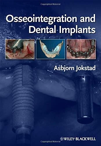OSSEOINTEGRATION AND DENTAL IMPLANTS By Asbjorn Jokstad - Hardcover *Excellent*