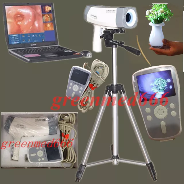 CE Electric Colposcope video Carema 800,000 pixels Color LED Handle +Tripod