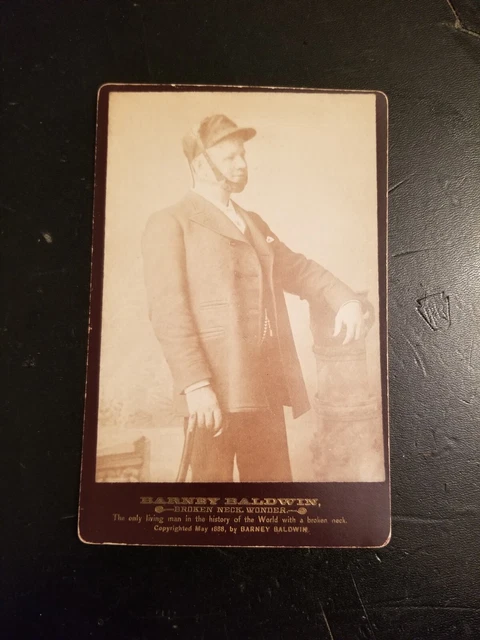 Cabinet Card Photo Barney Baldwin Broken Neck Freak Show Circus medical oddity