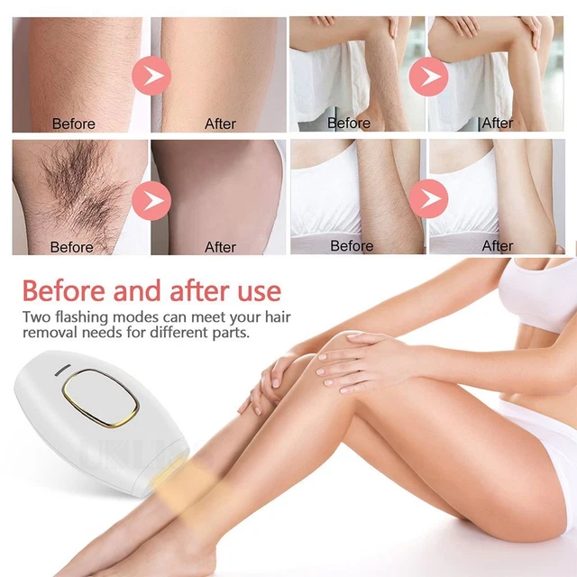 Epilierer IPL-Gerät Rosa/Weiß/Schwarz 500000 Blitze Haaren tfernung Epilierer