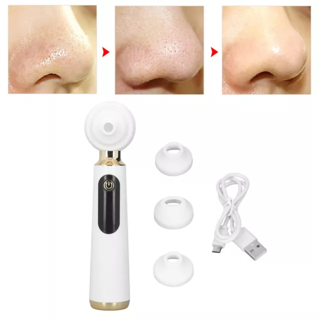 Facial Pores Cleaning Machine Blackhead Removal Vacuum Cleaner 3 Suction