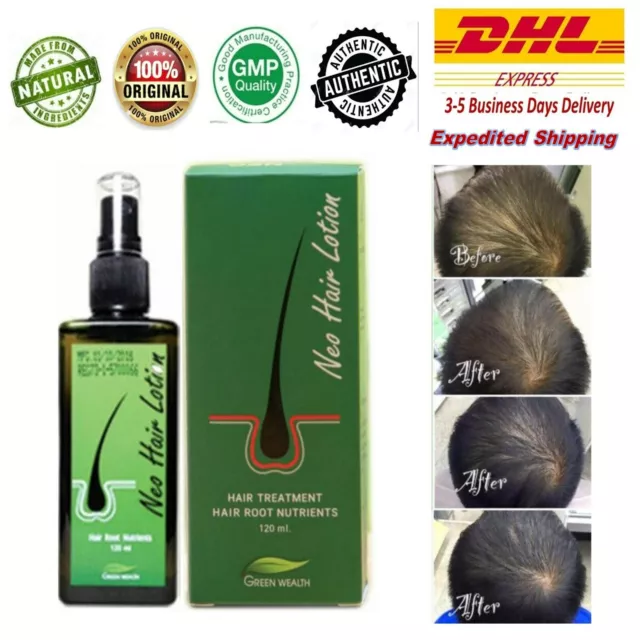 120ml. Neo Hair Lotion Green Wealth for Hair Growth Root Prevent Hair Loss