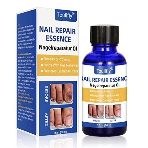 Traitement ongles,Champignon Ongles Traitement, Traitement Ongles, Favorise la R