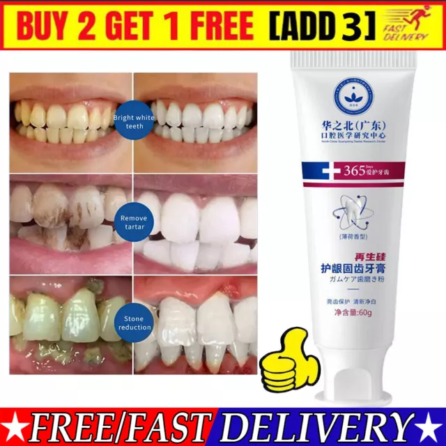 Toothpaste Quickly Repair Gums Decay Cavities Caries Protect Teeth Whitening UK