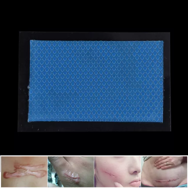 Silicone Removal Patch Reusable Acne Gel Scar Silicon Sheet Skin ZJP WODMG 2