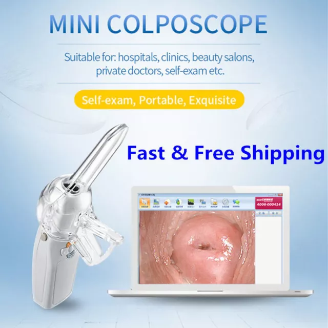 Digital Portable Video Electronic Mini Colposcope FA2 with 3000000 Pixels Camera