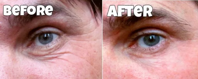 WATCH OUR AMAZING VIDEO Instant Facelift remove reduce deep wrinkles cream serum