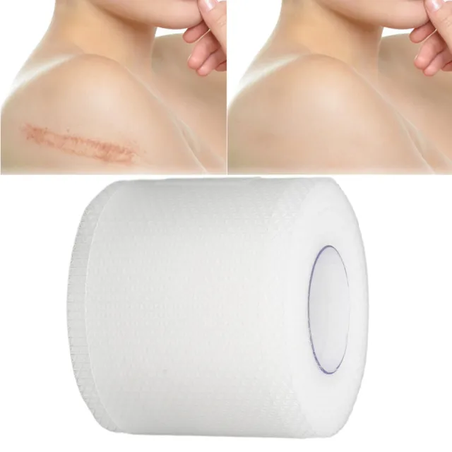 Scar Tape Silicone Sheet Repair Sticker Breathable 3 Meter For Surgery Scald FS1