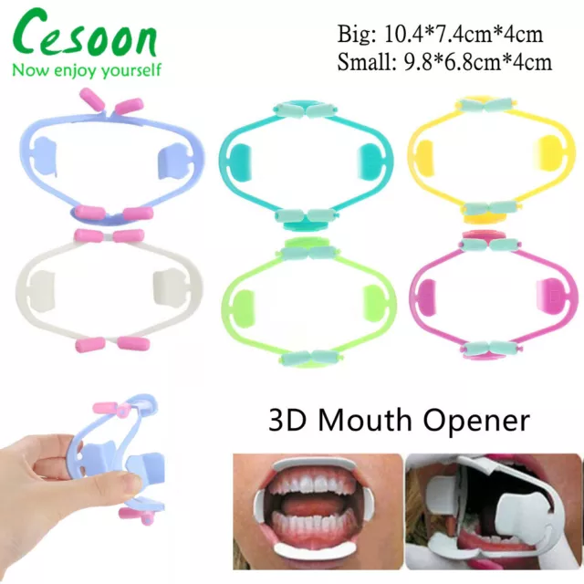 Dental 3D Mouth Opener Intraoral Cheek Lip Retractor Orthodontic Oral Props Gag